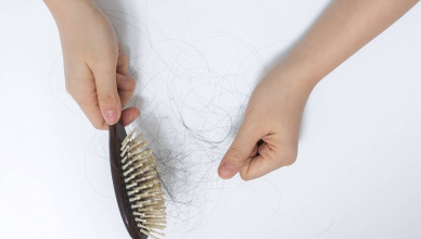 Queda de cabelo: causas mais comuns